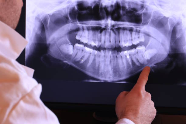 Best Walk-In Emergency Dentist in Galax, VA