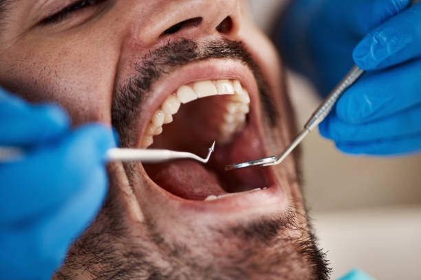 Best Emergency Broken Tooth Repair in Galax, VA