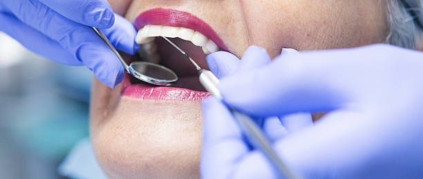 Best Emergency Tooth Extraction in Galax, VA